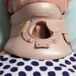 Tracheostomy Care Tracheostomy Care